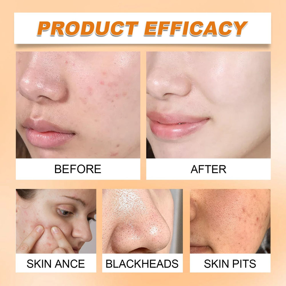 Tbexem Turmeric Face Wash travel pack demonstrates on-the-go cleansing.