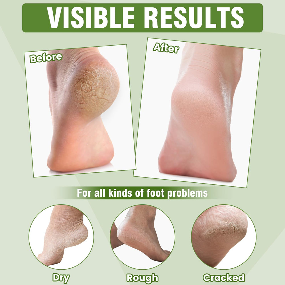 TEAWOO moisturizing socks being applied for easy at-home foot care