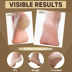 TEAWOO wearing foot mask demonstrates easy at-home pampering during downtime.