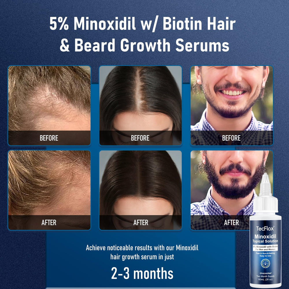TECFLOX spiral-cap-application highlights precise, mess-free scalp targeting.