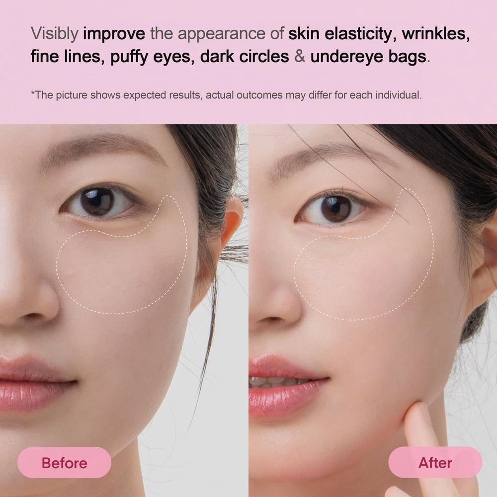 TEREZ & HONOR eye patches on the eye area smoothing fine lines.