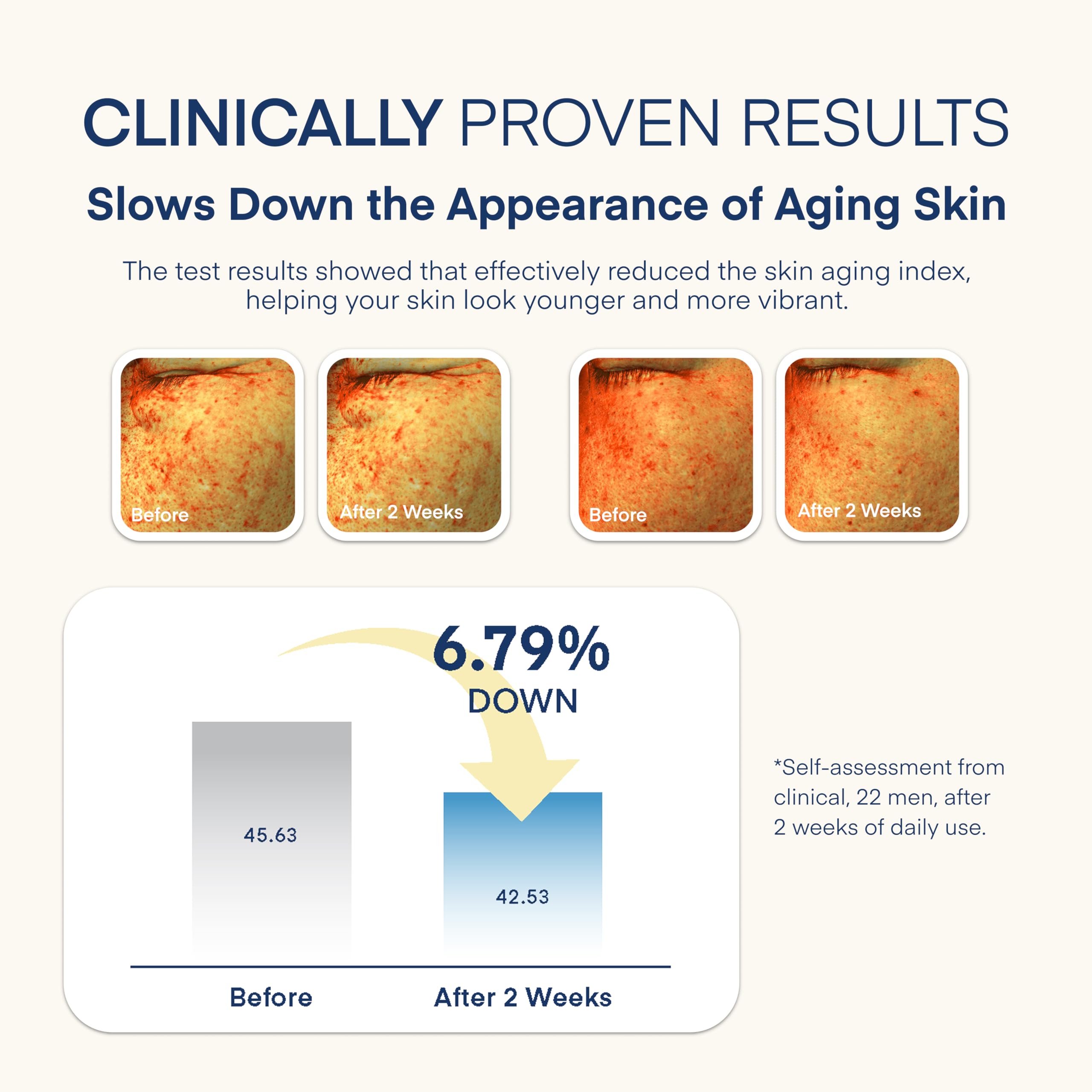 TEREZ & HONOR under-eye area brightening and puffiness support.