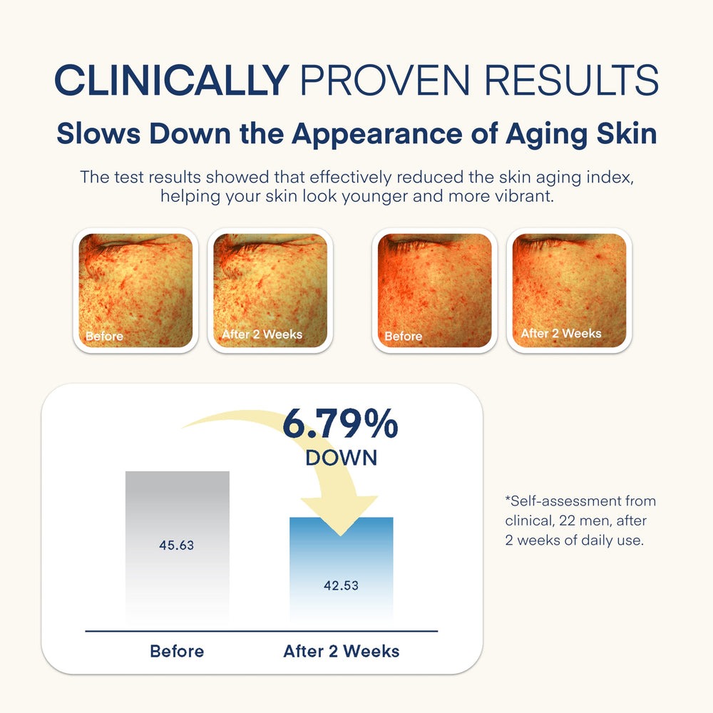 TEREZ & HONOR under-eye area brightening and puffiness support.
