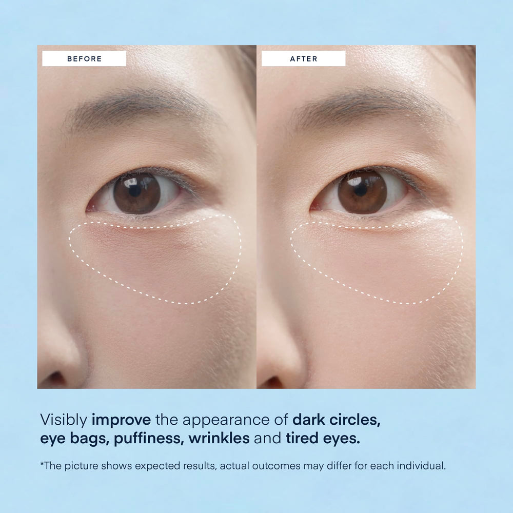TEREZ & HONOR Under Eye Patches being applied to the under-eye area for soothing hydration.