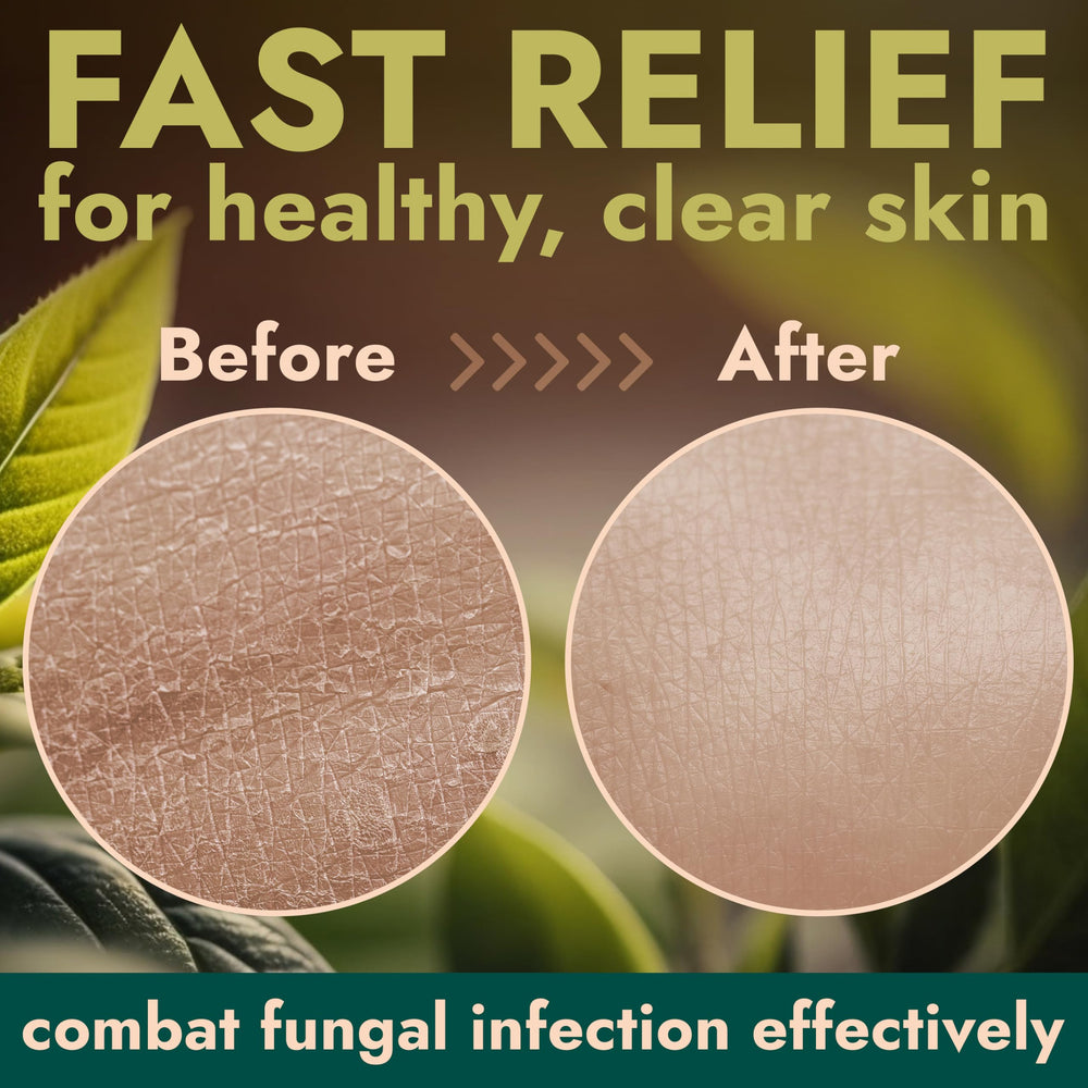 Terramed Just Think Comfort back acne closeup illustrating targeted cleansing and clarity.