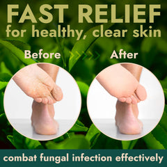 Terramed Just Think Comfort tea tree oil purifying action visible in scrub.