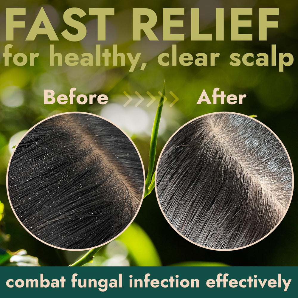 Terramed Just Think Comfort Tea Tree Scalp Scrub with quartz powder offering gentle exfoliation and scalp refreshment.