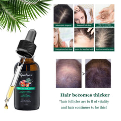 Tgideas Rosemary Batana Oil scalp-application for easy massaging across roots.