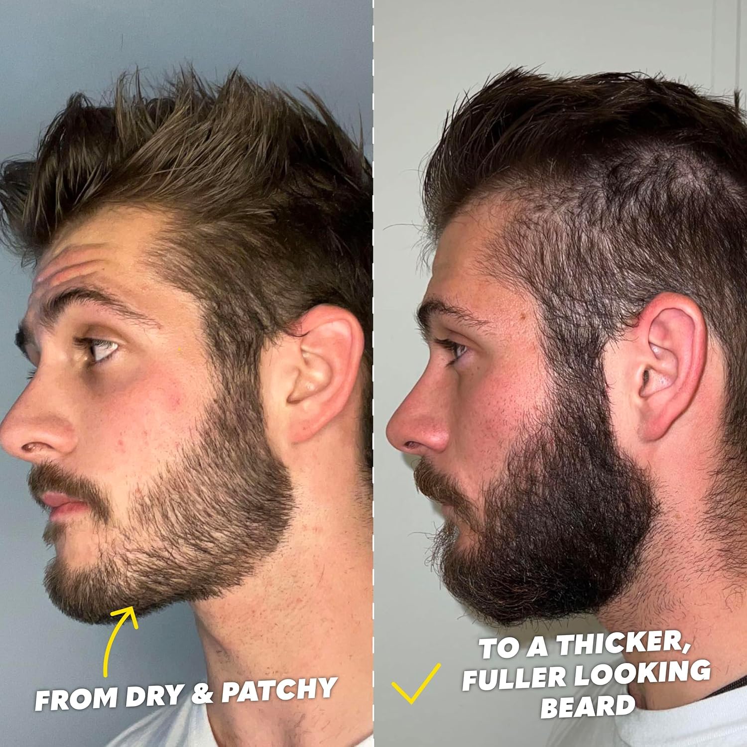 The Beard Club biotin beard balm emphasizing softening and itch reduction.