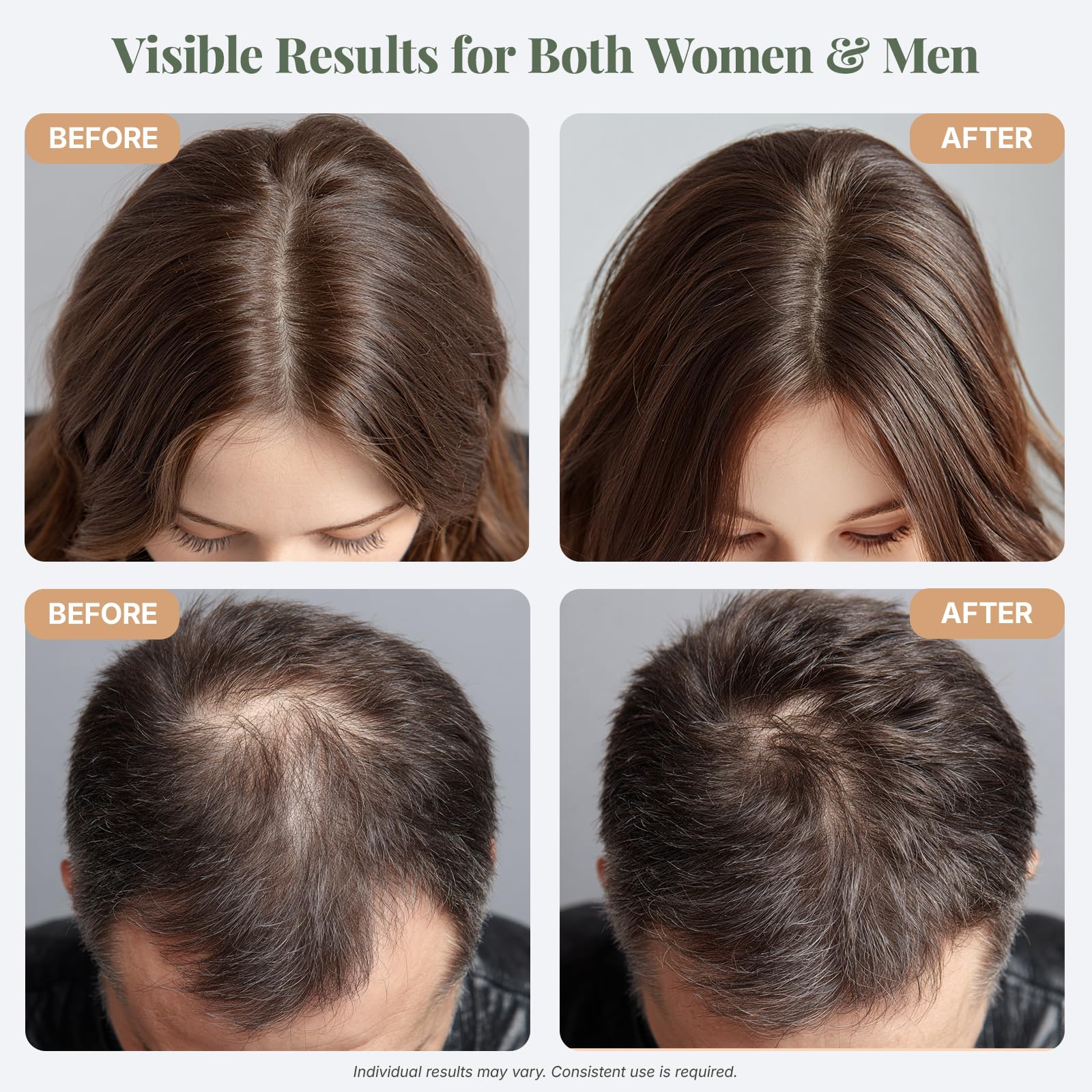 The ÉLIX application dropper demonstrates precise easy-to-use scalp treatment