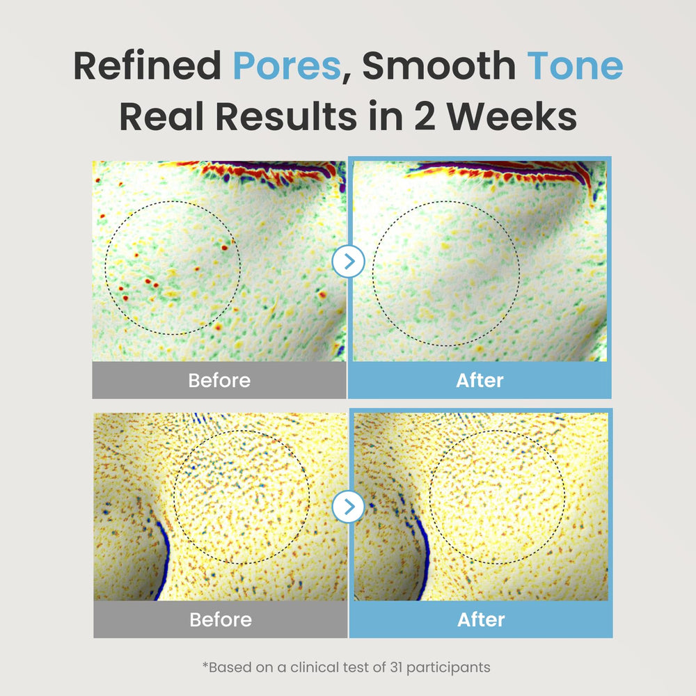 The Face Shop Alltimate Niacinamide serum texture closeup looks lightweight.