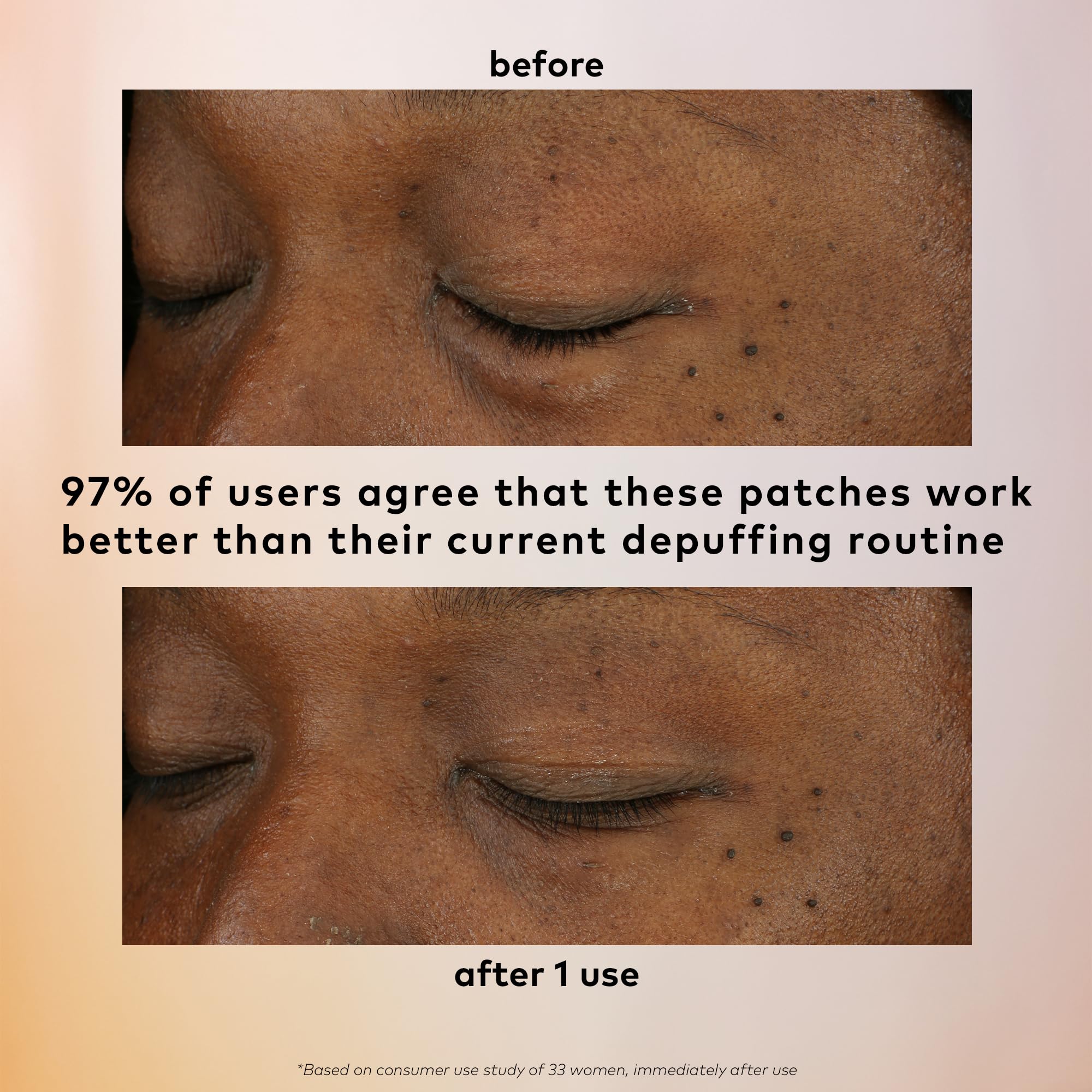 The Good Patch de-puff application scene showing patch placement on clean skin.