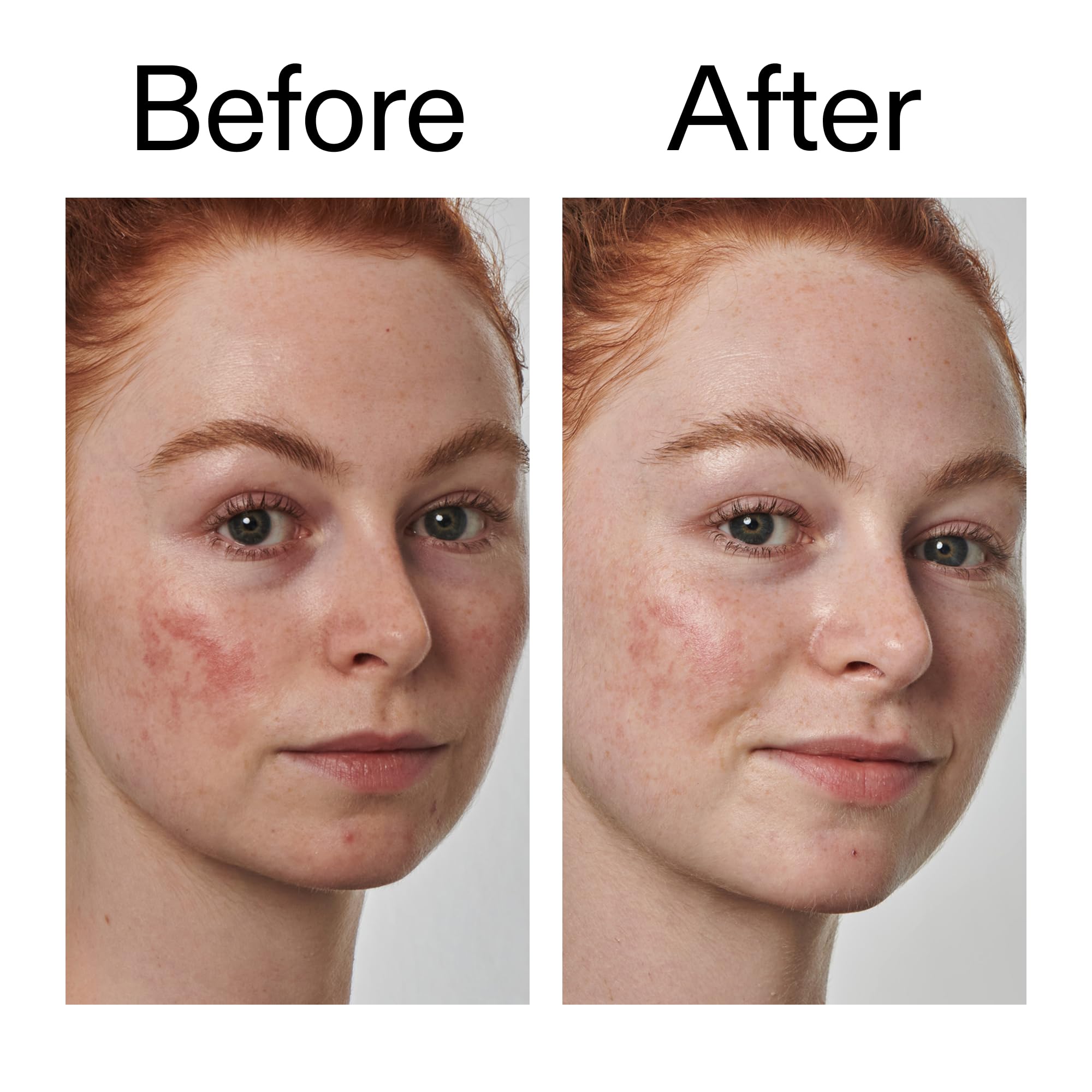 The INKEY List azelaic acid serum ingredients label highlights 10% option