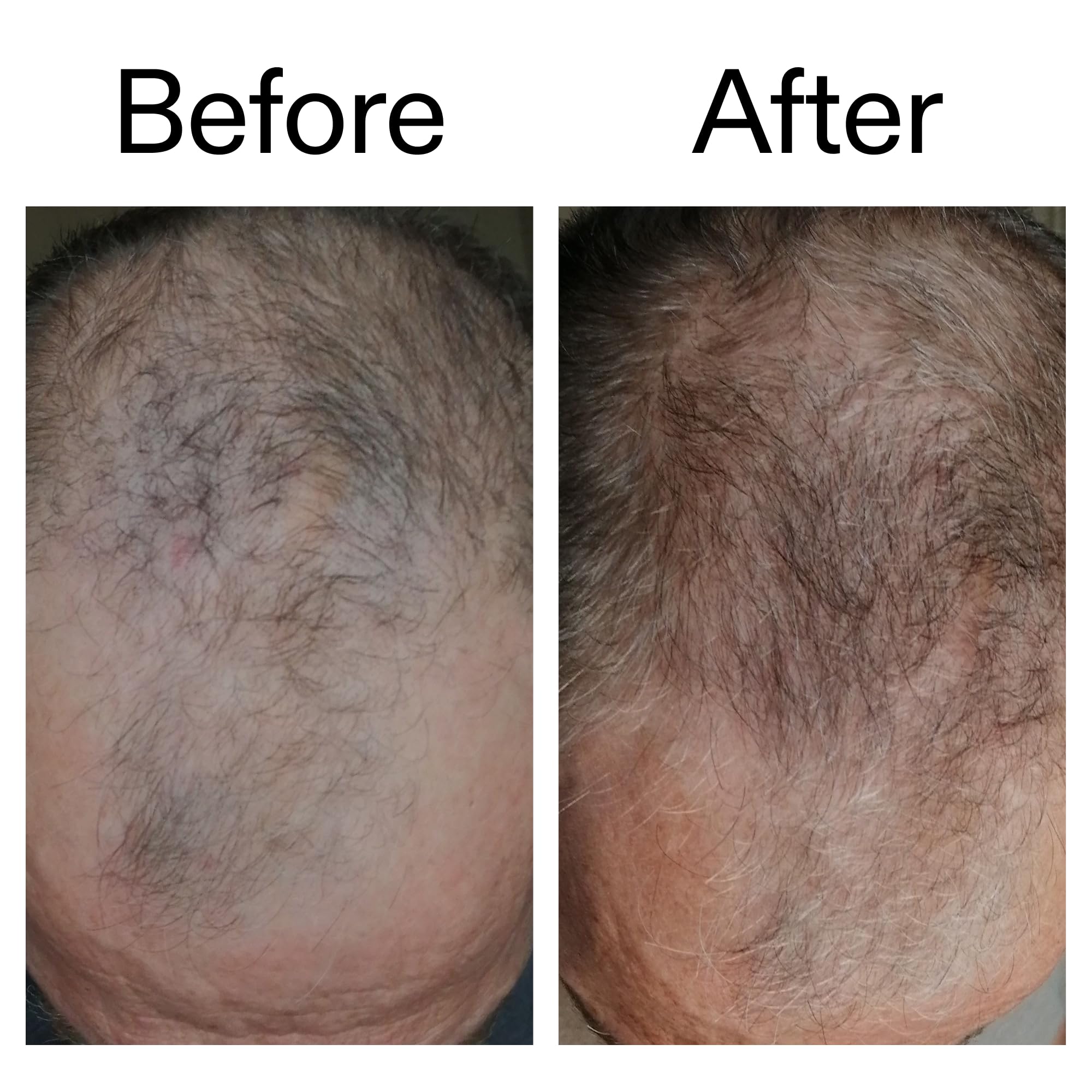 The INKEY List caffeine scalp treatment result after washing demonstrates soft hair.