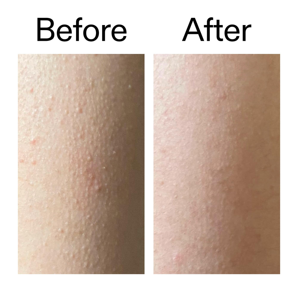 7% Glycolic and Salicylic acids icons on INKEY Stick