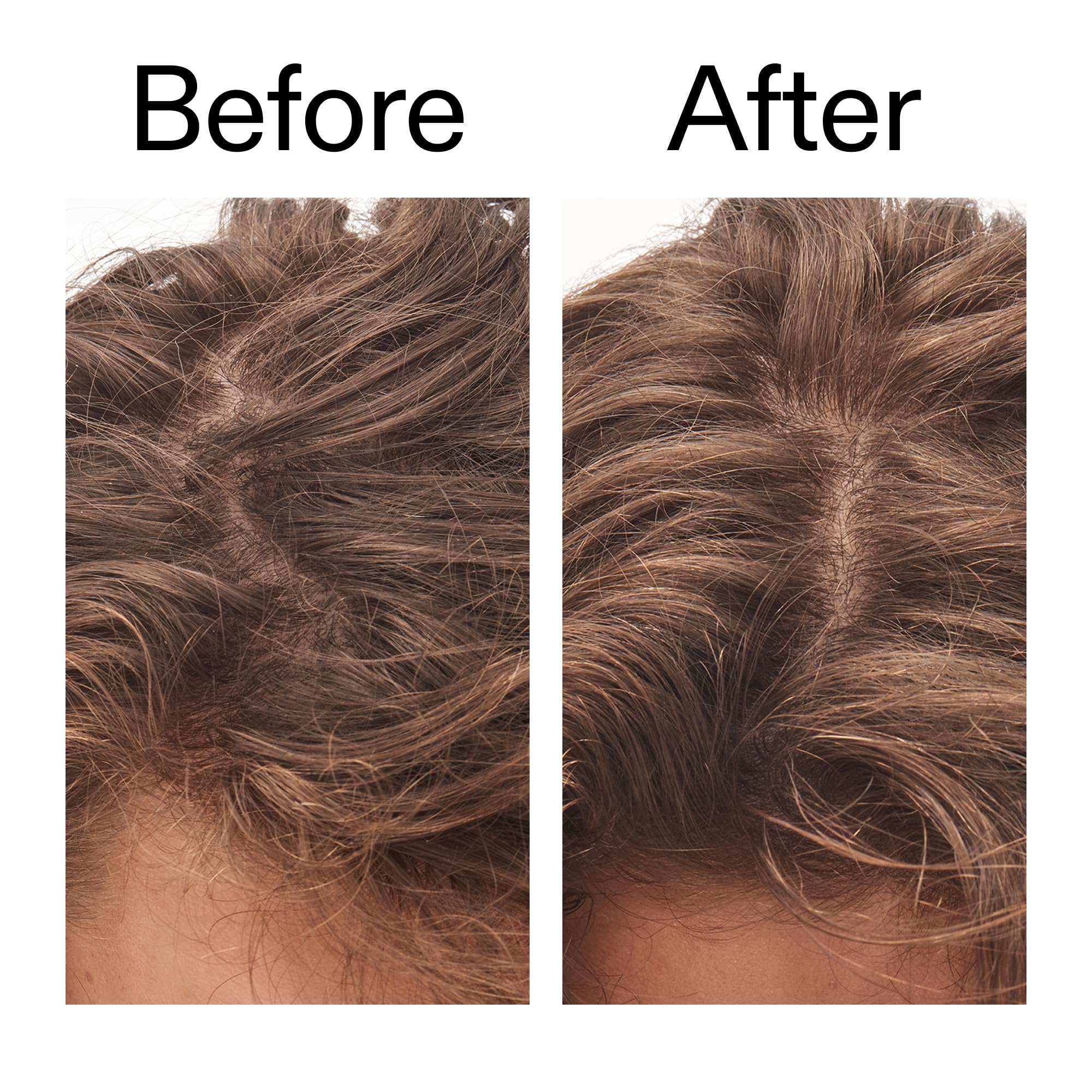 Foamy lather from The INKEY List Glycolic Acid Exfoliating Scalp Scrub during cleansing.