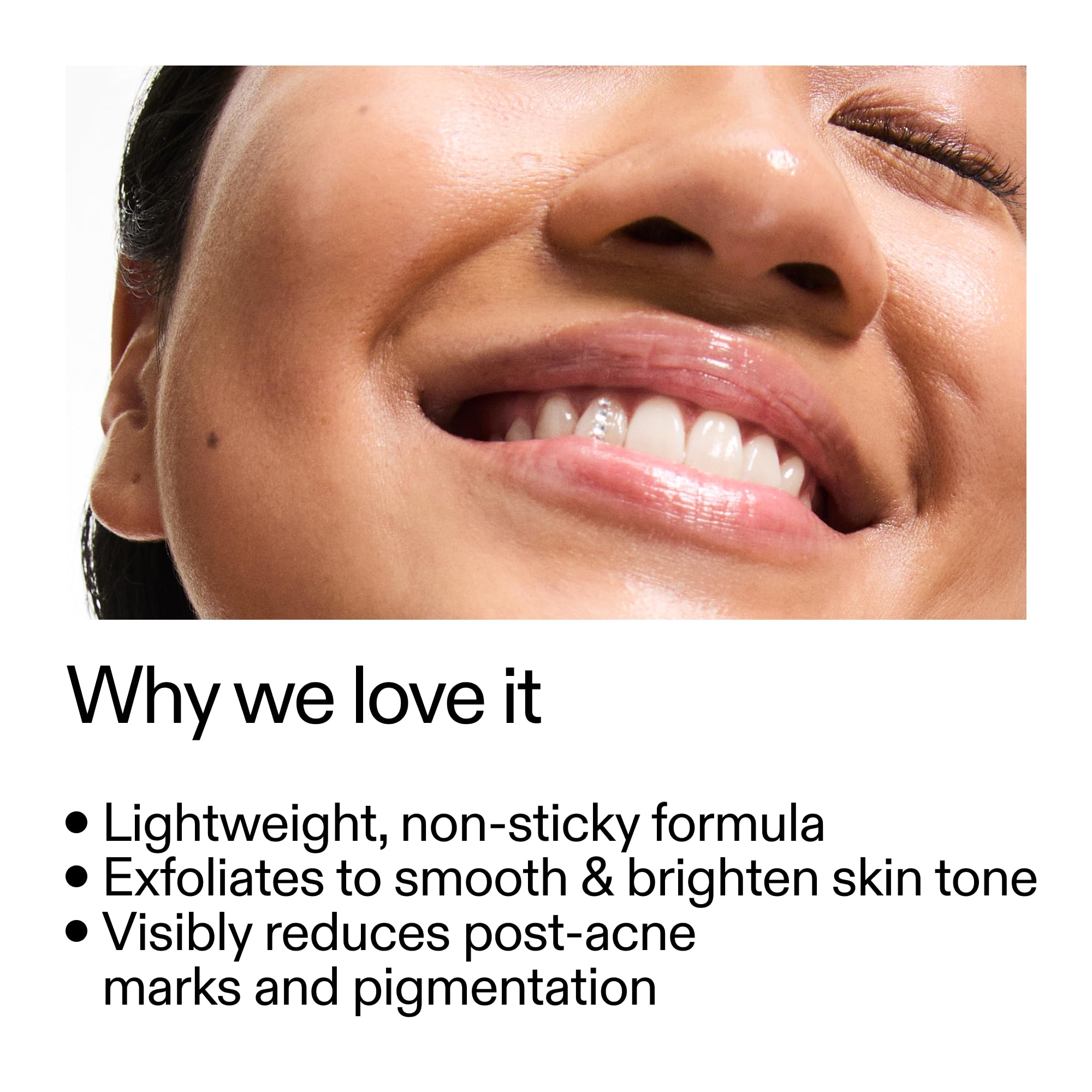 The INKEY List Mandelic Acid Treatment bottle close-up highlights a clear, lightweight texture.