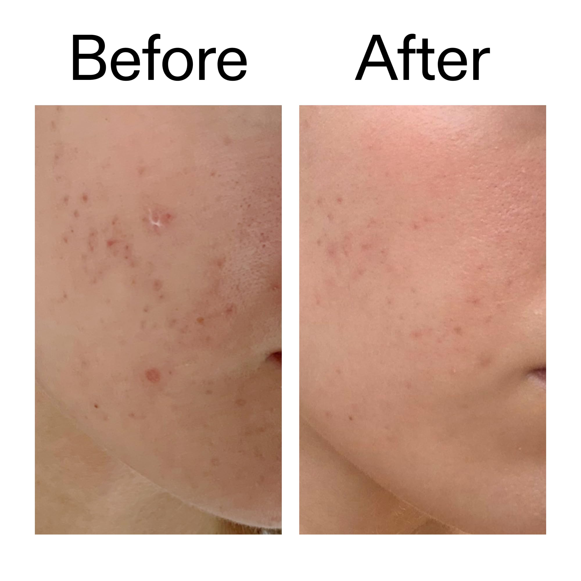Illustration shows various skin types benefiting from Mandelic Acid Treatment.
