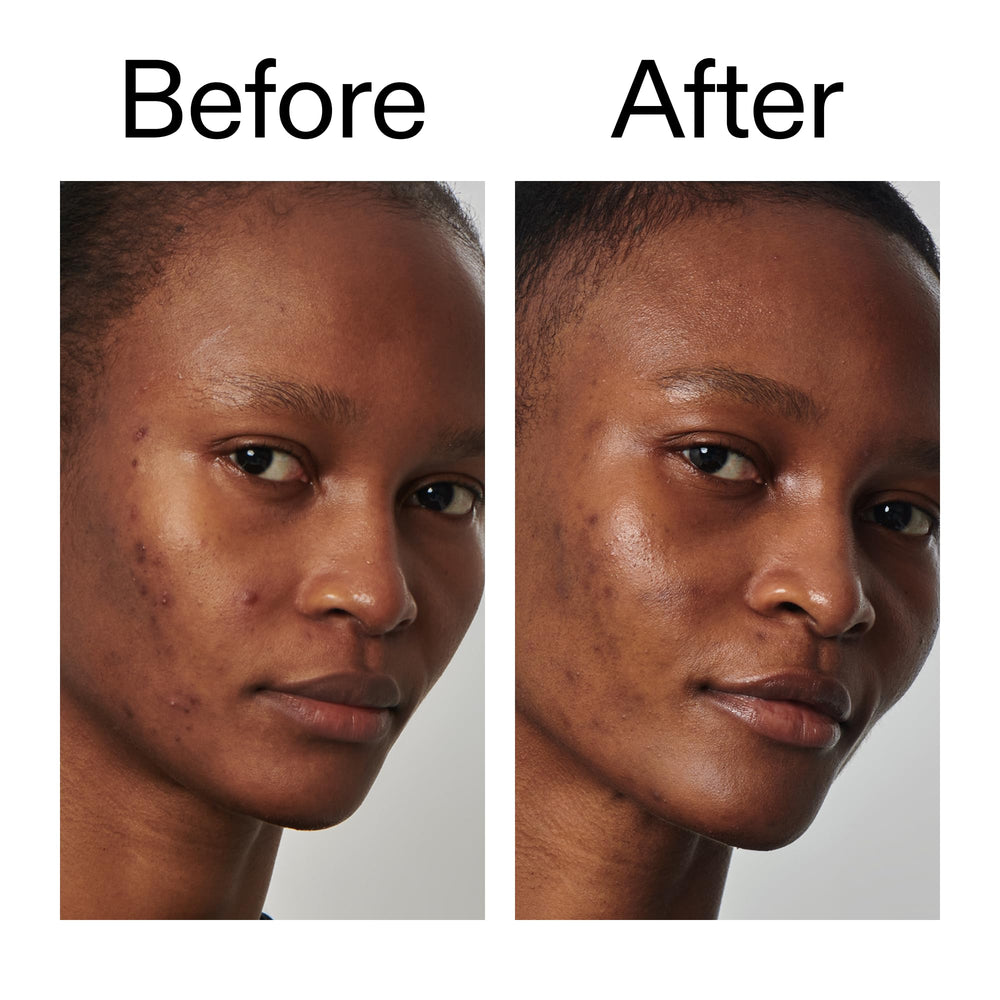 The INKEY List Niacinamide serum routine-use setup supports simple, repeatable skincare steps.