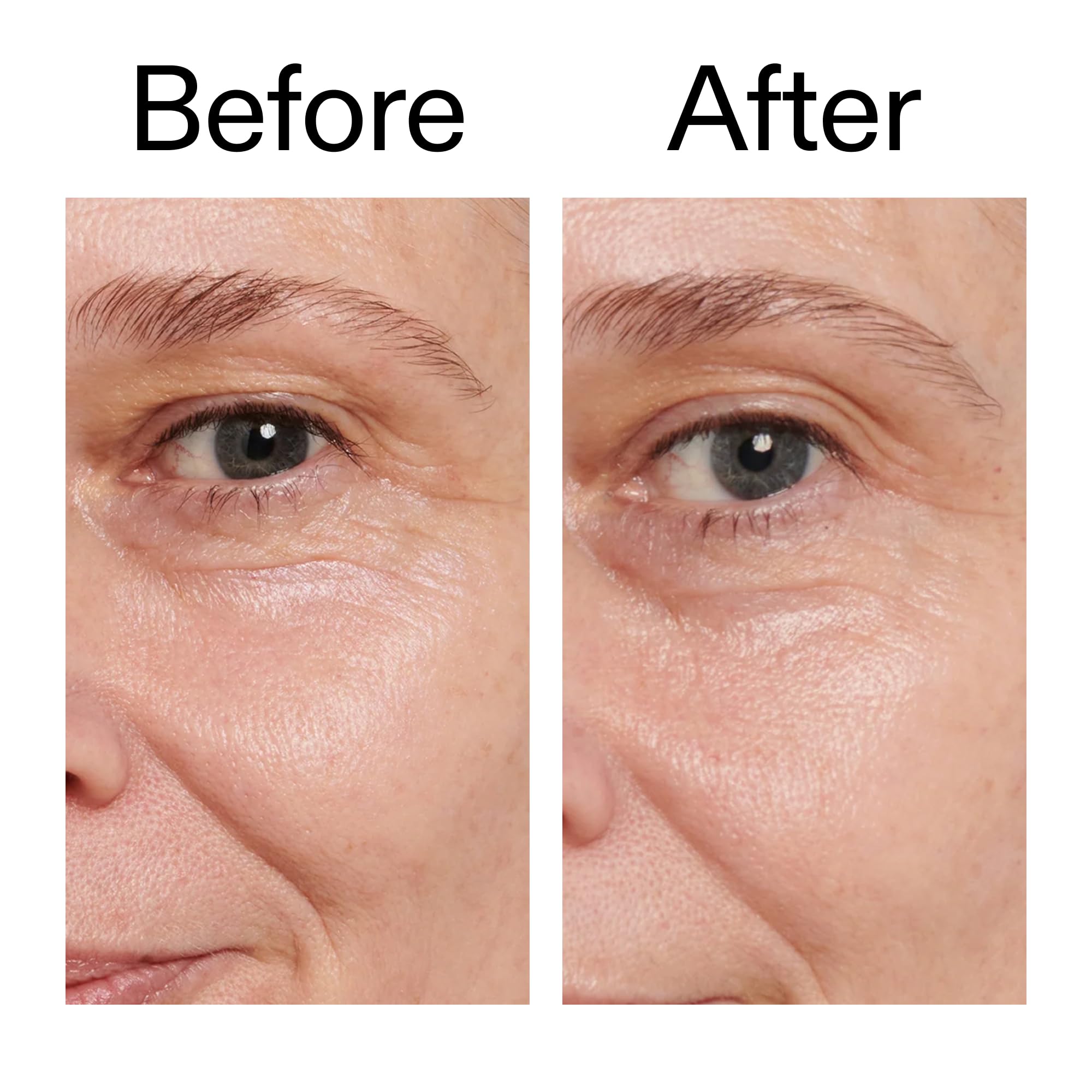 The INKEY List Retinol Eye Cream application step showing gentle patting around the eye