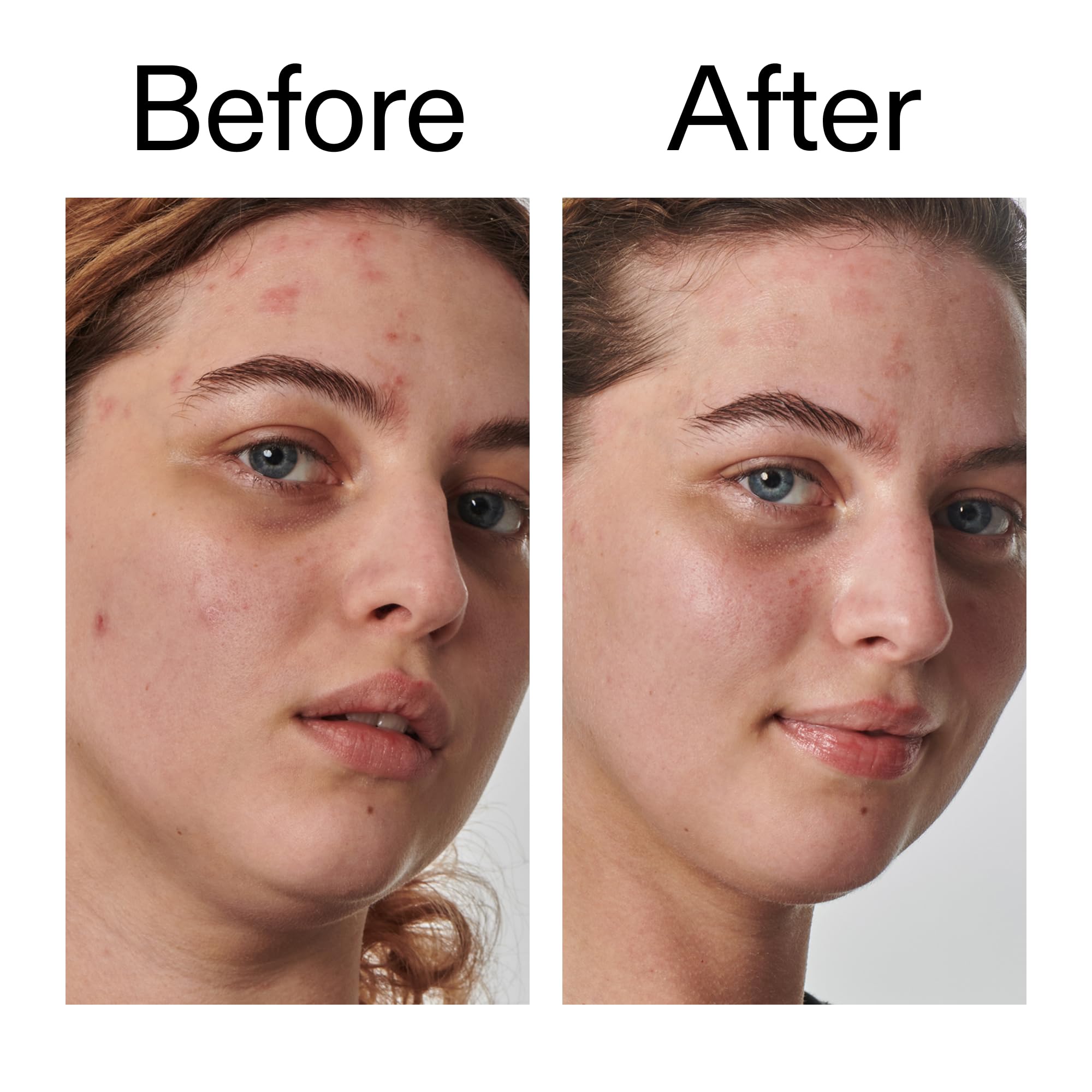 The INKEY List Urea 10% moisturizer in AM and PM skincare routine setup