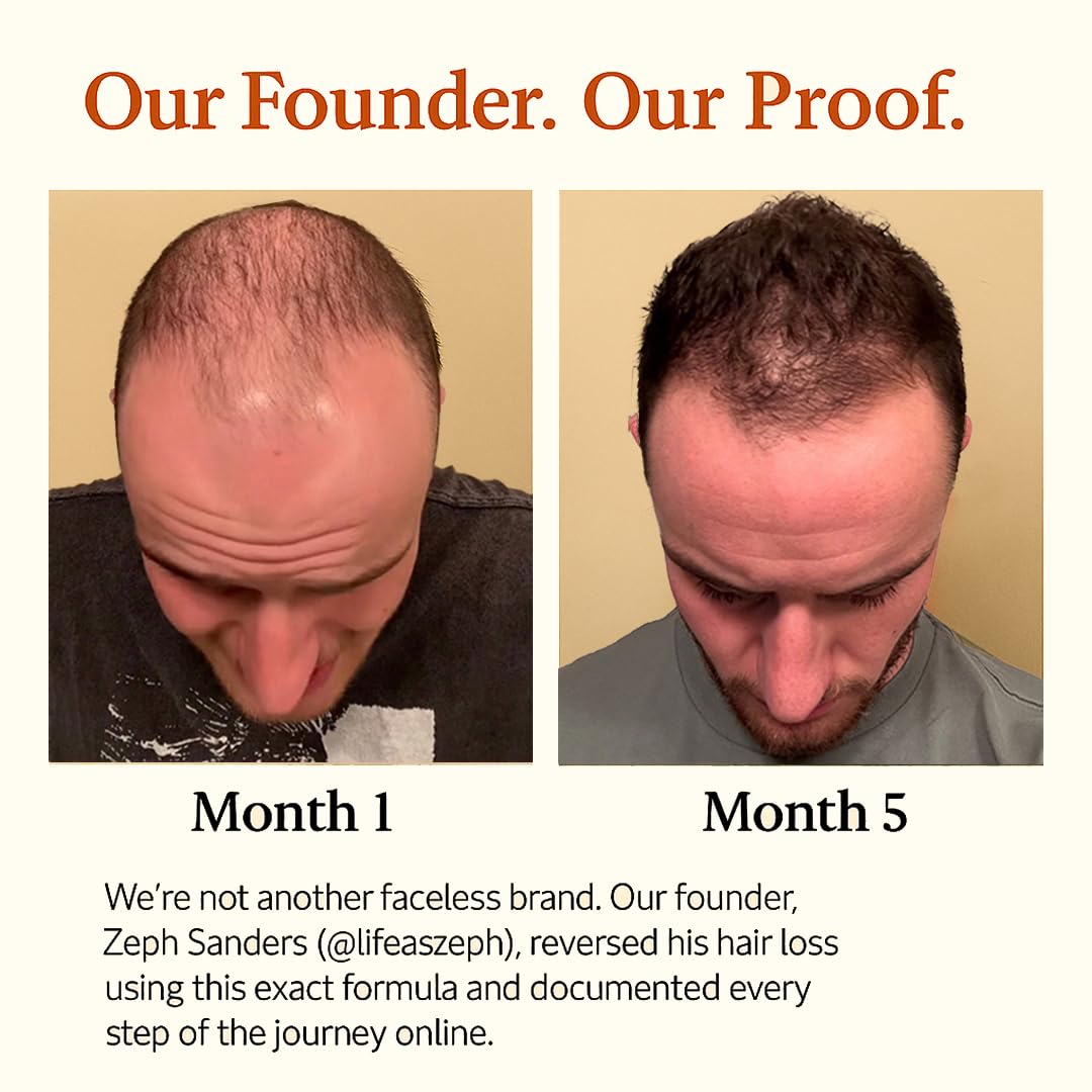 The Mane Solution Mane Elixir bottle back label—11 benefits in one bottle.