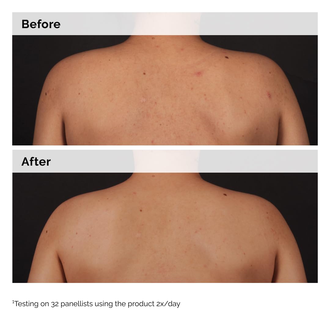 The Ordinary label and ingredient list for clear product information