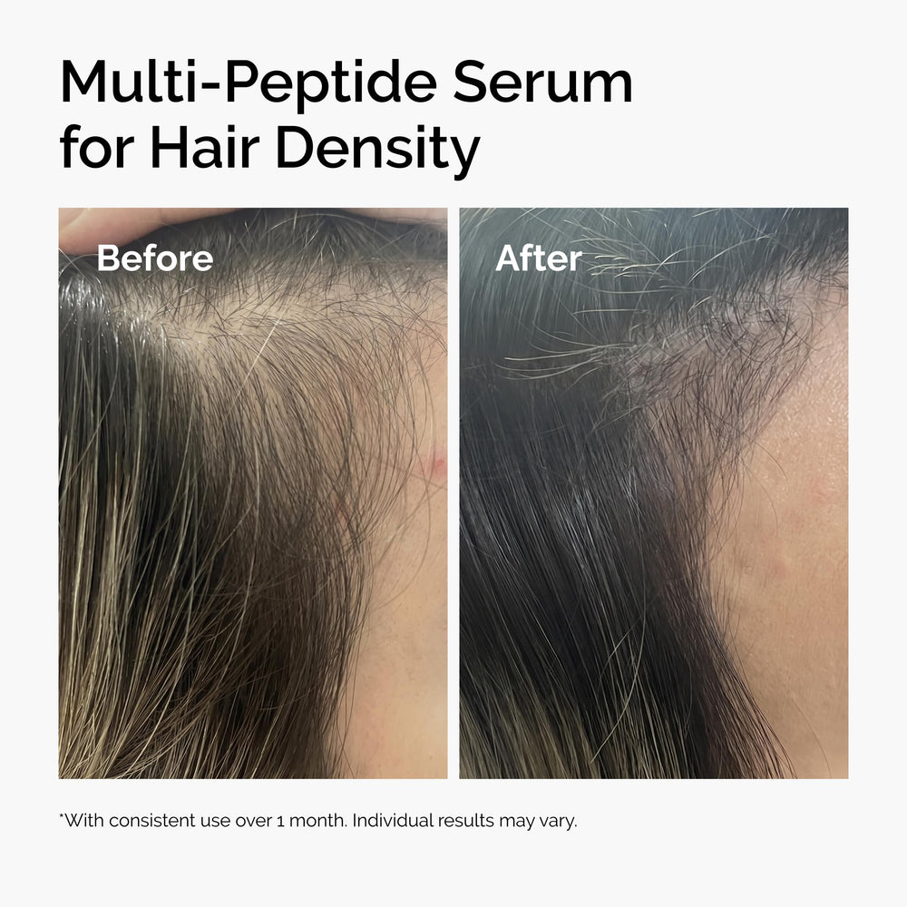 The Ordinary on bathroom counter as part of nightly hair routine