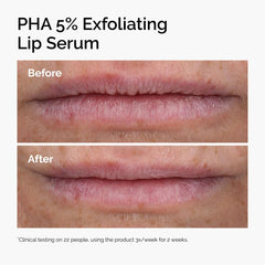 The Ordinary lip serum applicator close-up displaying doe-foot tip for precise nightly application benefit