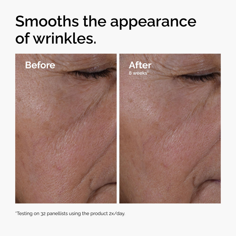 The Ordinary applied near eye area demonstrating targeted use
