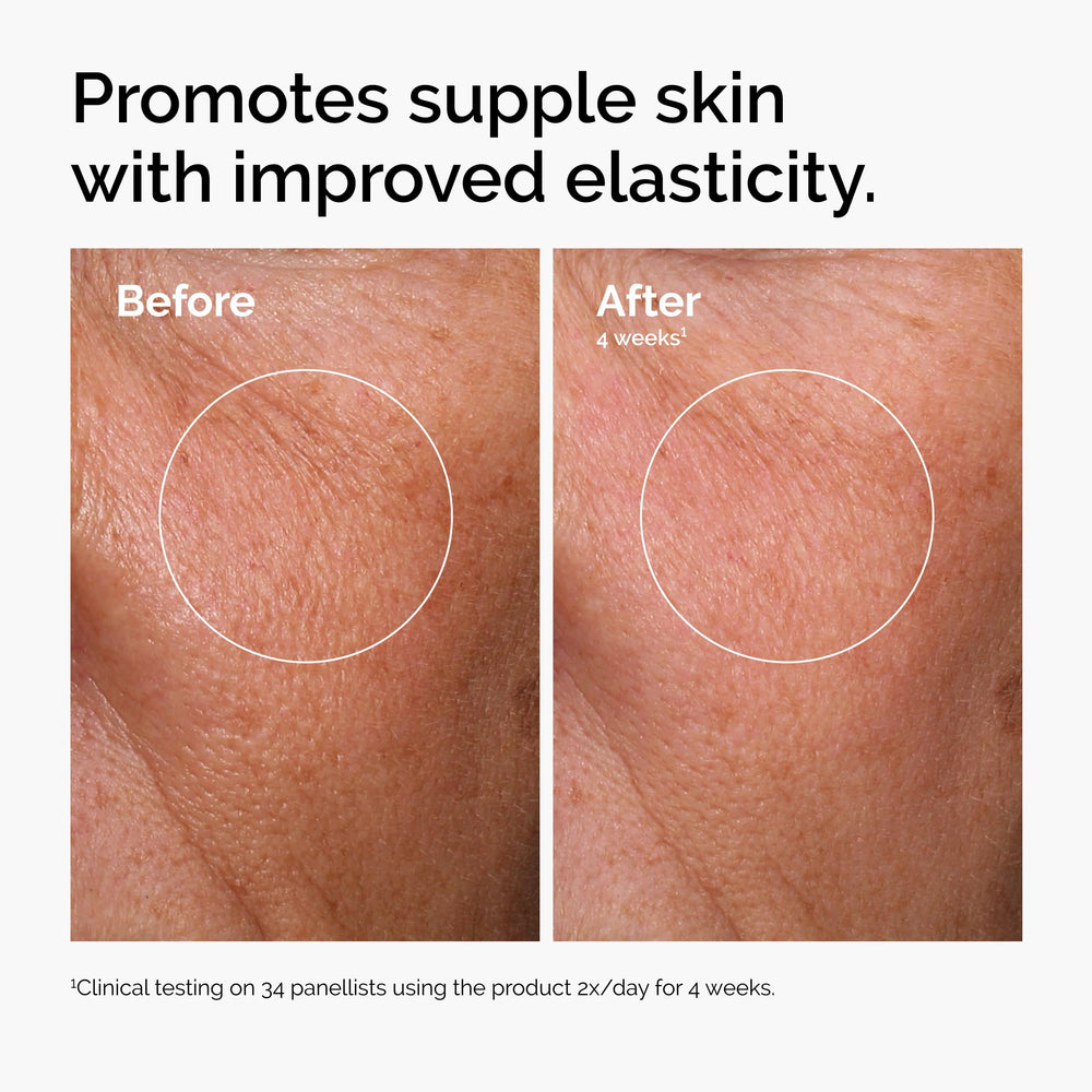 The Ordinary niacinamide serum dropper dispensing clear formula for pores