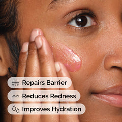 The Ordinary serum drop on hand demonstrating soothing application