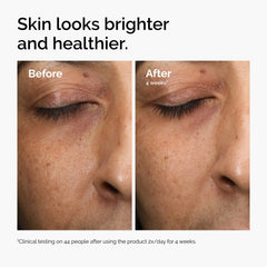 The Ordinary pipette droplet on skin illustrating targeted application and quick spreadability
