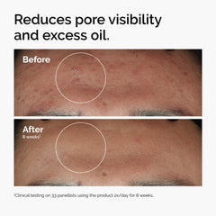 The Ordinary serum texture droplet on skin demonstrating fast absorption and lightweight hydration