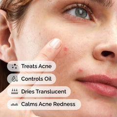 The Ordinary sulfur open bottle powder visible for precise dispensing benefit