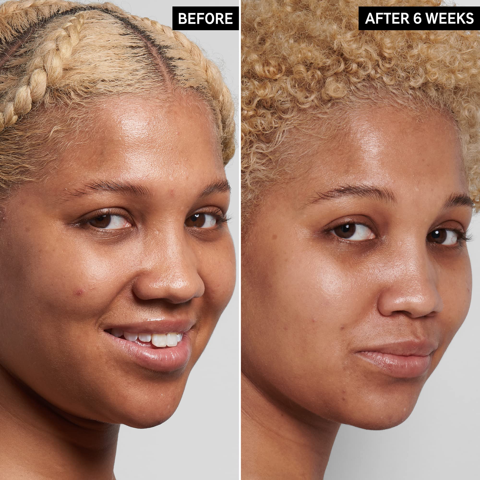 The INKEY List 1% Hyaluronic Acid image highlights hydration without heaviness.