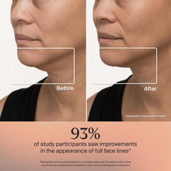 TheraFace mask blue light acne therapy close-up supports clearer-looking skin