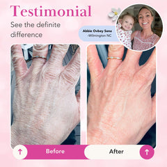 Theraplex Clear Lotion Spray bottle with NEA Seal highlights trusted protection.