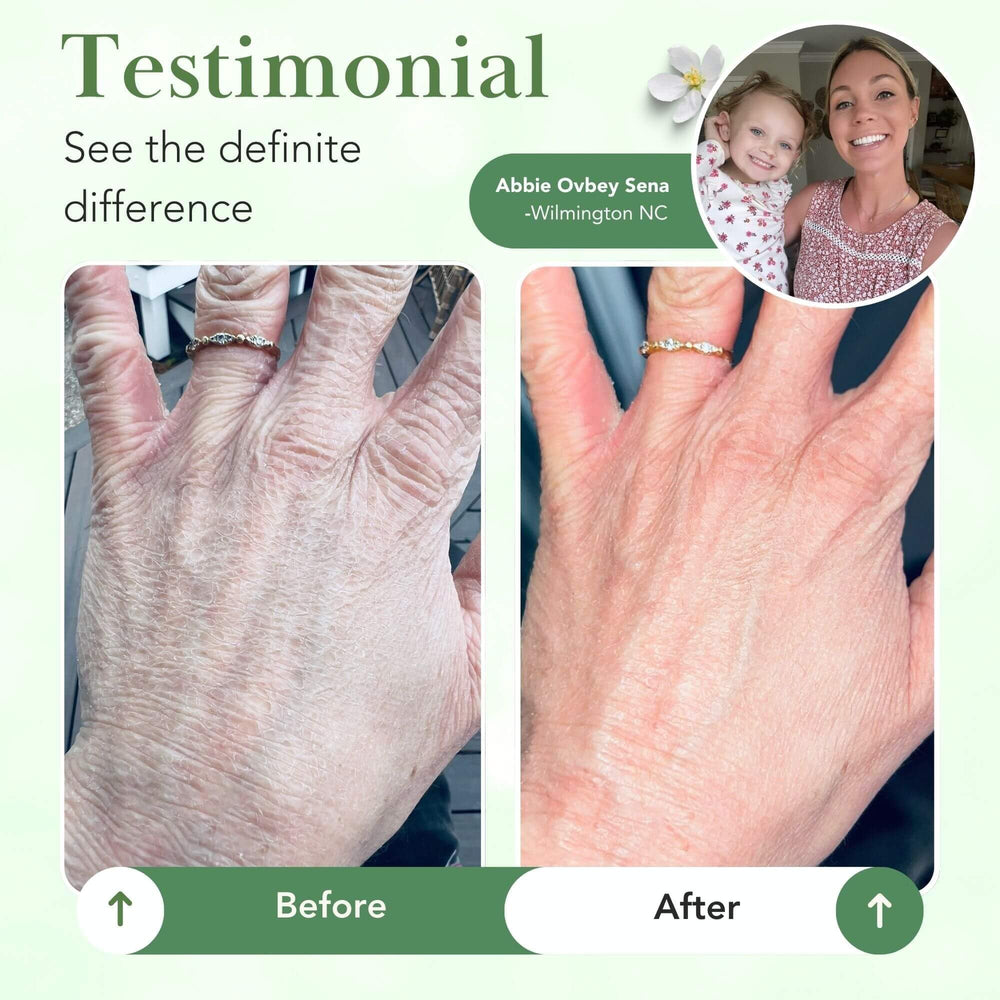 Theraplex dermatologist-recommended balm on shelf conveys trusted barrier repair.