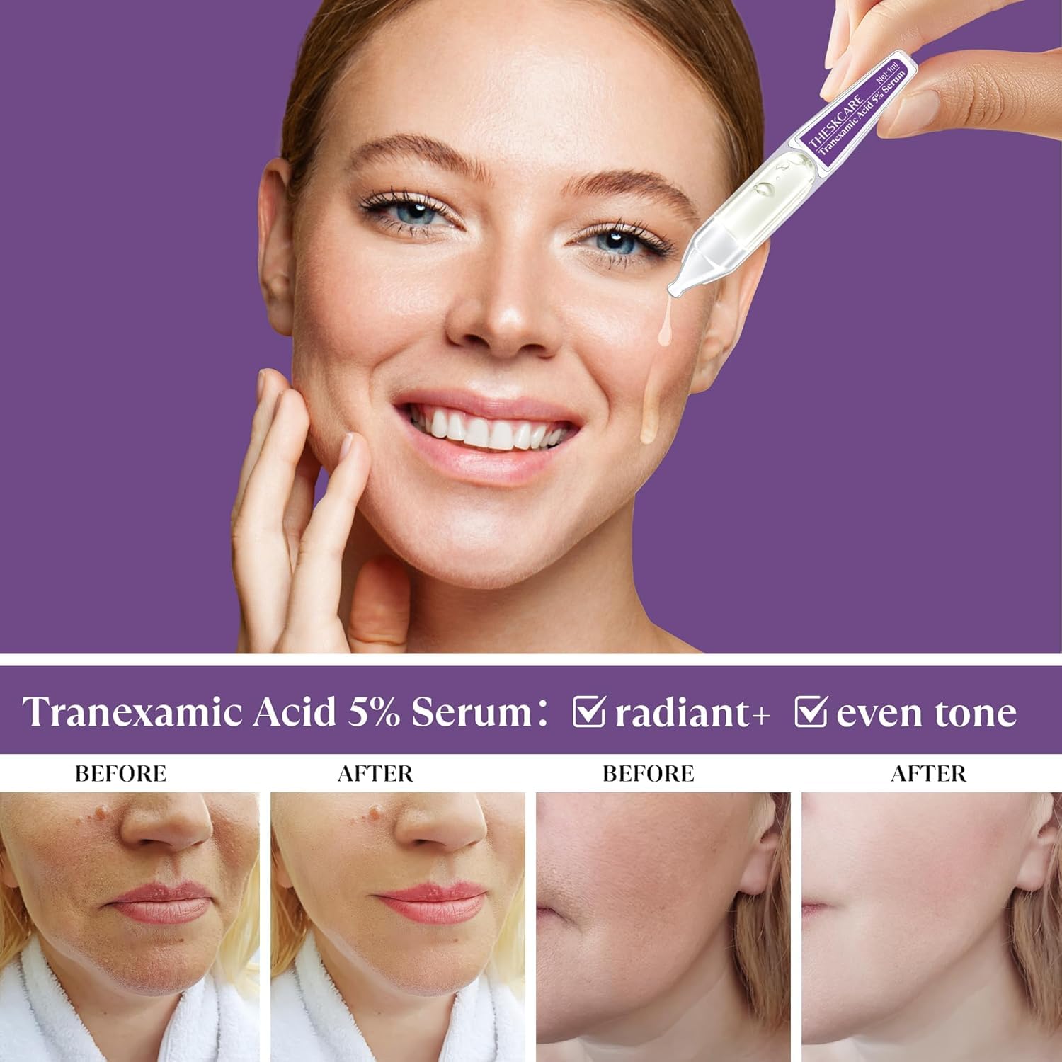 THESKCARE Tranexamic Acid Serum ampoule bottle, compact packaging for quick daily use.