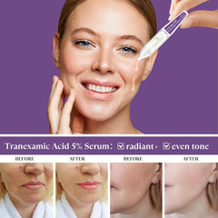 THESKCARE Tranexamic Acid Serum ampoule bottle, compact packaging for quick daily use.