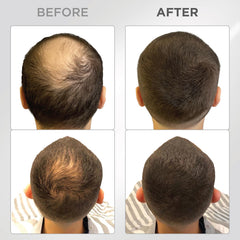 Thick Fiber hair fibers applied to dry thinning areas for natural coverage