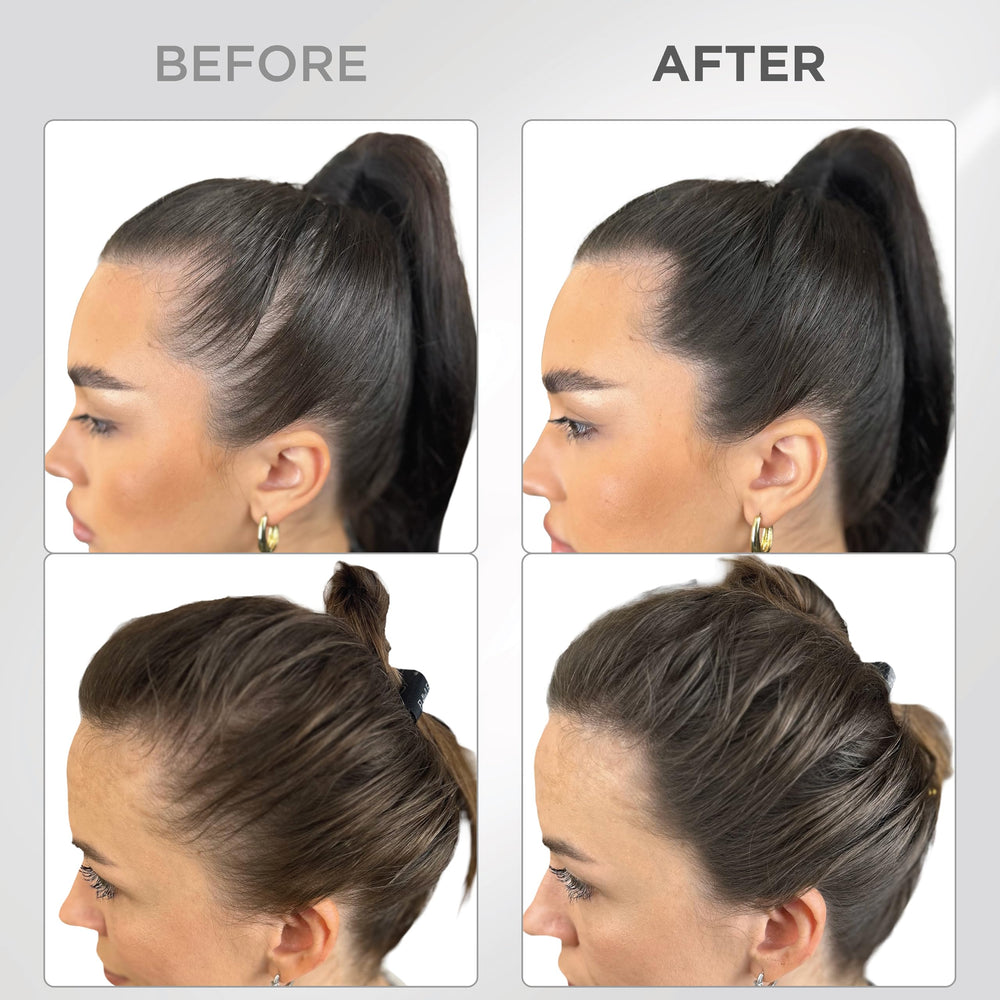 Thick Fiber Root Touch Up Powder hairline coverage demonstrates instant thinning concealment