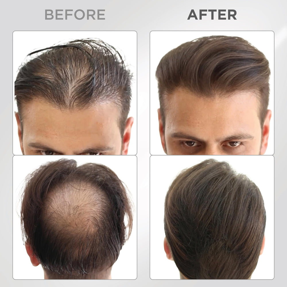 Thick Fiber close-up on thinning area blending with natural hair for fullness