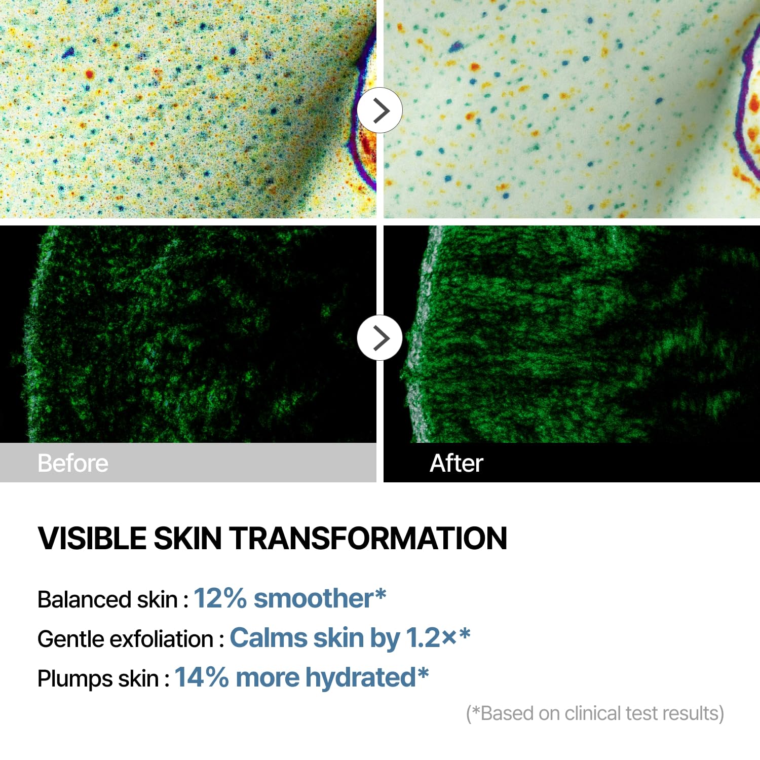 THOME G-Peel exfoliate application demonstrating gentle multi-acid exfoliation