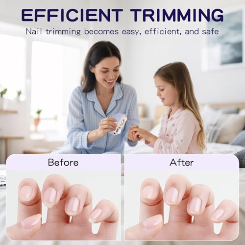 Tialexa electric nail clipper in use with light on for precise trimming in low light