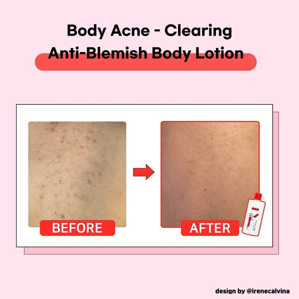 TIA'M Anti-Blemish Body Lotion milky consistency image shows fast-absorption feel.