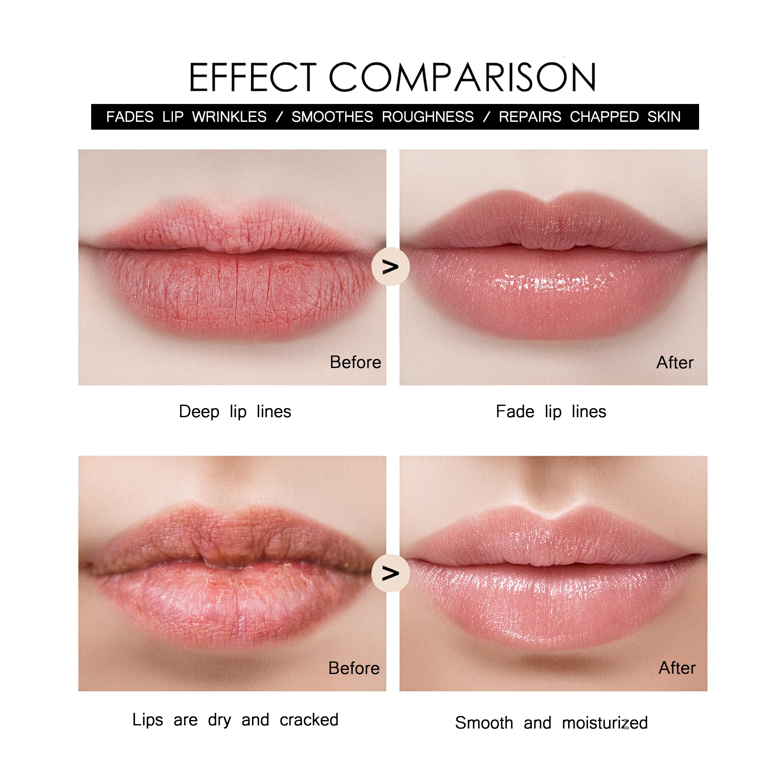TIDEWISH derma roller eye-area targets delicate skin for fine lines.