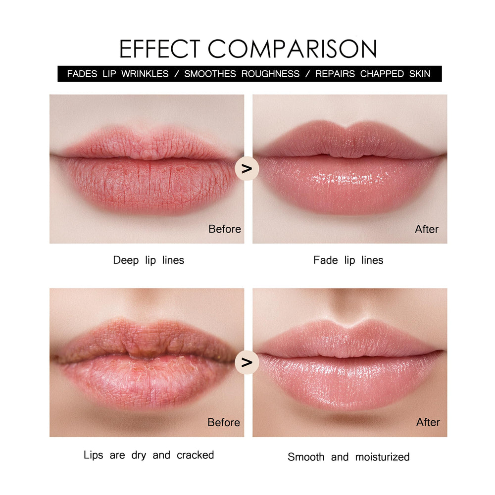 TIDEWISH derma roller eye-area targets delicate skin for fine lines.