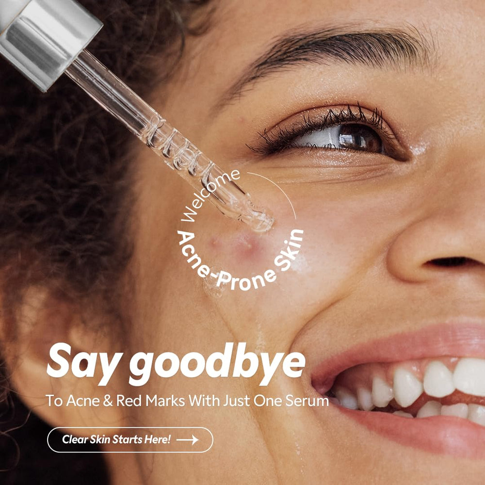TIRTIR Azelaic Acid 12% Serum texture swirl showcases refined texture and even tone.
